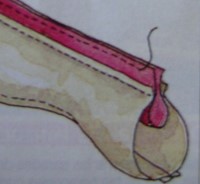 burlete3