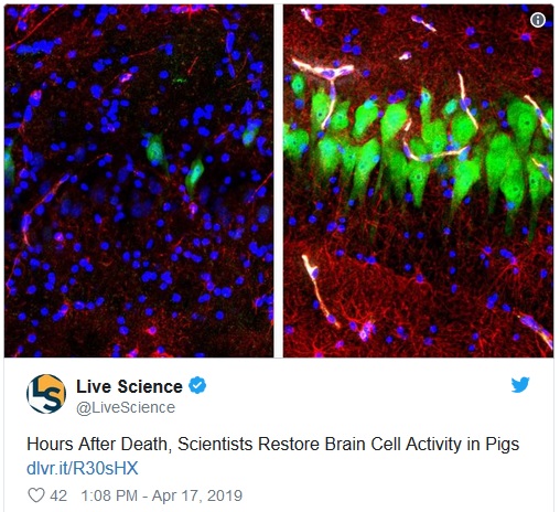 Neuronas32sssulo