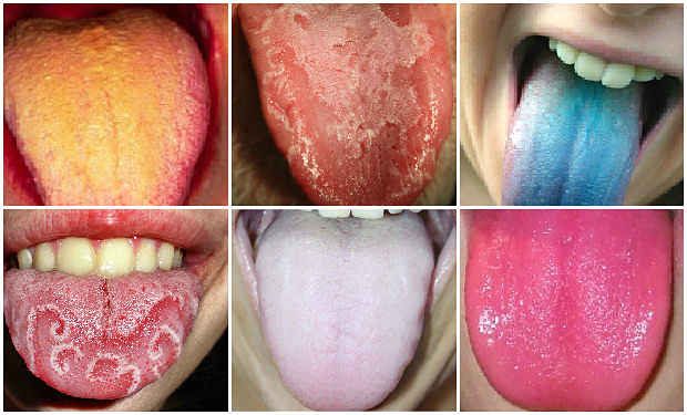 color-de-lengua