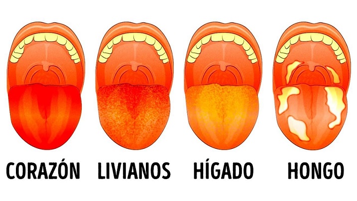 color444-de-lengua