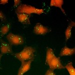 Una ‘start-up’ biomédica rusa pretende revolucionar el diagnóstico de cáncer