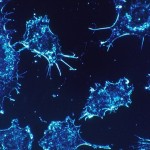 Cómo el silicio puede detectar casos de cáncer