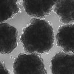 Un brasileño logra crear un microcerebro con genes de Neandertal