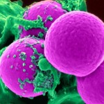 Hallan un modo de reactivar las células que destrozan el cáncer