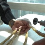 El hombre que llevaba sin cortarse las uñas desde 1952 acaba de poner fin a su récord con una sierra mecánica