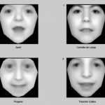 Del reconocimiento facial al reconocimiento de enfermedades genéticas