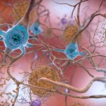 Científicos europeos creen haber descubierto un intrigante método para crear fármacos contra el Alzheimer