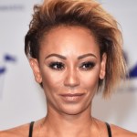 ¿Mel B podría quedarse ciega a pocas semanas del tour de las Spice Girls?