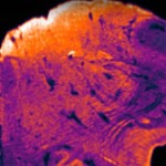 Descubren una región desconocida del cerebro humano
