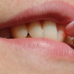 7 hábitos que dañan tus dientes más de lo que crees