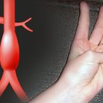Cómo saber si padecemos una condición cardiovascular grave moviendo un solo dedo