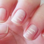 ¿Cuánta atención hay que prestarle a las manchas blancas en tu uñas? (Para Chicas)
