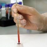 Encuentran maneras sencillas de reducir el riesgo de contraer cáncer