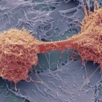 CancerSEEK, detección precoz de 8 tipos de cáncer mediante un simple análisis de sangre
