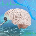 Un implante cerebral con IA permite a un paciente sin habla hablar en dos idiomas