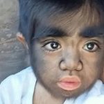 El insólito caso de Jaren, el niño más peludo del mundo: su madre cree que está “maldito”