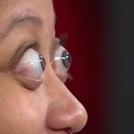 ¿Los ojos saltones son de enfermo?