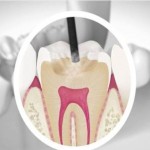 Nueva pasta de dientes sanará las caries