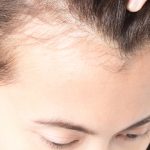 Por qué se cae el pelo | ¿Cuándo debemos preocuparnos?