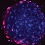Científicos identifican prometedor fármaco contra el cáncer de próstata
