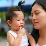 Las alergias a los alimentos ya no serán un problema para los niños