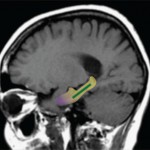 El cacao revierte el deterioro de la memoria relacionado con la edad – afirma estudio
