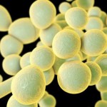 Qué es el Candida auris, el misterioso hongo resistente a los medicamentos que se expande por el mundo (y ya llegó a América Latina)