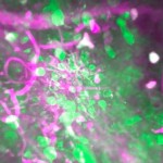 La mejor imagen de un cerebro despierto