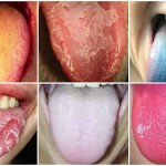 Lo que dice de tu salud el color de tu lengua