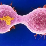 Microscopios mejorados para luchar contra el cáncer de mama