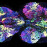 Descubren las células madre que desarrollan el cerebro