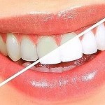 10 Formas de eliminar las manchas de sarro en tus dientes