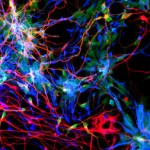 La selección natural está causando una disminución en los genes humanos de la educación