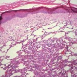 Han hecho un importantísimo descubrimiento en la lucha contra el cáncer