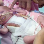 El extraordinario caso médico de la niña que ha nacido en Reino Unido con el corazón fuera del pecho