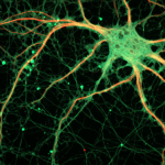 Los opiáceos de nuestro cerebro son mejores que la morfina