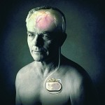 Marcapasos cerebral: una herramienta con mucho potencial