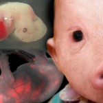 Crean el primer híbrido entre un humano y un cerdo