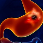 Desarrollan micromotores alimentados por los ácidos del estómago
