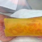Crean innovador parche de miel que evitaría amputaciones en pacientes con diabetes