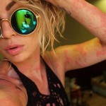 Tras años de burlas por sus psoriasis, ella se canso…