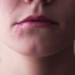 ‘Periodo ventana’, el plazo que ayuda a detectar enfermedades sexuales