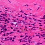 UN CORAZÓN EN UN CHIP PARA MODELAR ENFERMEDADES HUMANAS