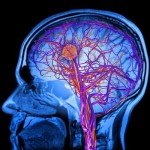 UN VIRUS PUEDE AYUDAR A LUCHAR CONTRA LOS TUMORES CEREBRALES